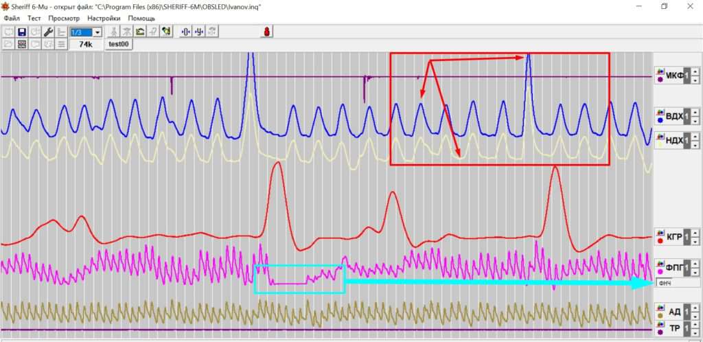 настройка програми шериф sheriff как добавить канал микрофона мікрофона sheriff polygraph поліграф полиграф