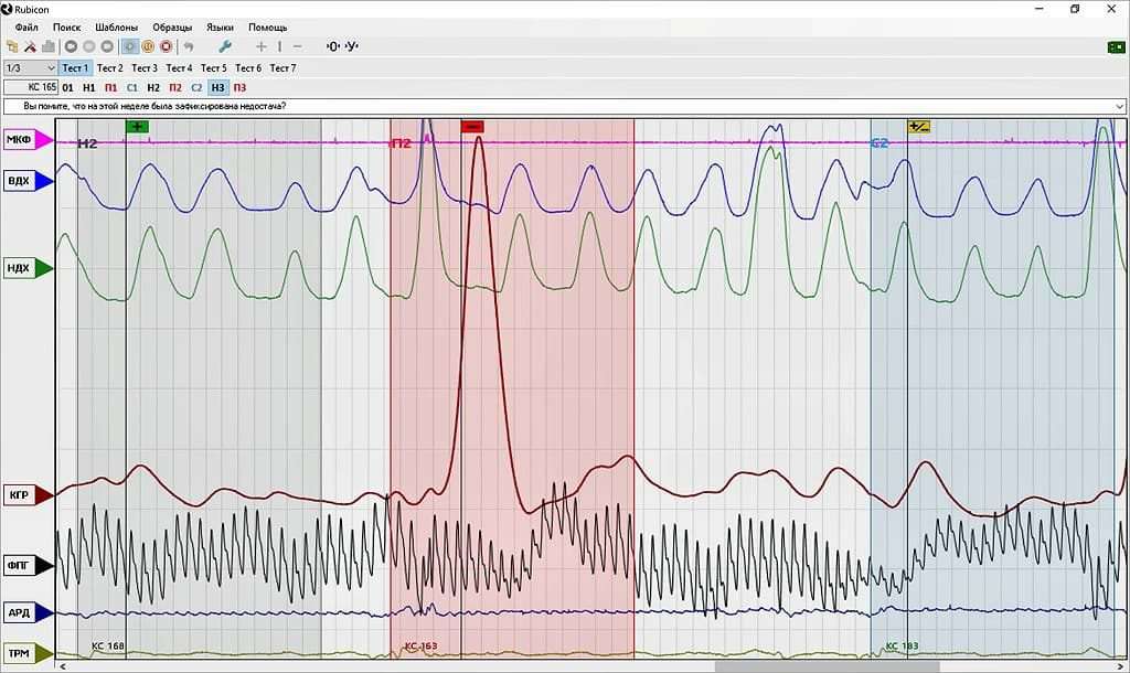 поліграма полиграмма поліграфа полиграфа