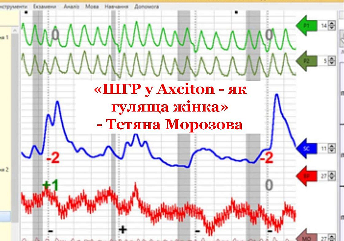 “ШГР у Axciton – як гуляща жінка… а Шериф №1” – Тетяна...
